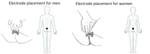 Where to Place Tens Pads for Pelvic Floor